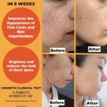 Big 2.11oz. Organic Vitamin C Serum for Face. Anti-Dark Spots, Wrinkles Skin Repair Serum with Hyaluronic Acid, Vitamin C & Niacinamide. All-in-One Brightening, Anti Aging Facial & Eye Area Skincare - Image 6