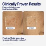 Cetaphil Healthy Radiance Brightening Serum with Niacinamide for Skin Pigmentation, 30ml, Packaging May Vary - Image 4