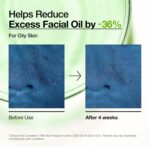 Anua Azelaic Acid 10 Hyaluronic Redness Soothing Serum, Facial Serum for Sensitive Skin, Hyaluronic Acid, Niacinamide, Spot Care, Natural Colour, Vegan, Korean Skincare (30 ml / 1.01 fl oz.) - Image 6