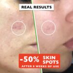 Big 2.11oz. Organic Vitamin C Serum for Face. Anti-Dark Spots, Wrinkles Skin Repair Serum with Hyaluronic Acid, Vitamin C & Niacinamide. All-in-One Brightening, Anti Aging Facial & Eye Area Skincare - Image 5